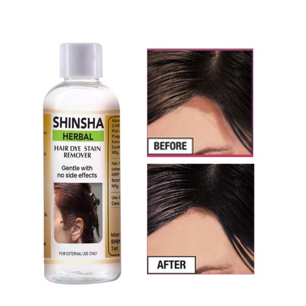 Shinshas Herbal Hair Dye Stain Remover - Image 2